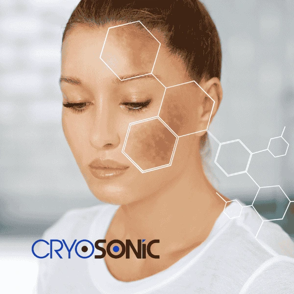 Are you looking for age spot removal treatment? Contact Cryosonic today in Shrewsbury
