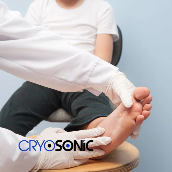 Are you looking for fast effective wart removal Contact us today Shrewsbury