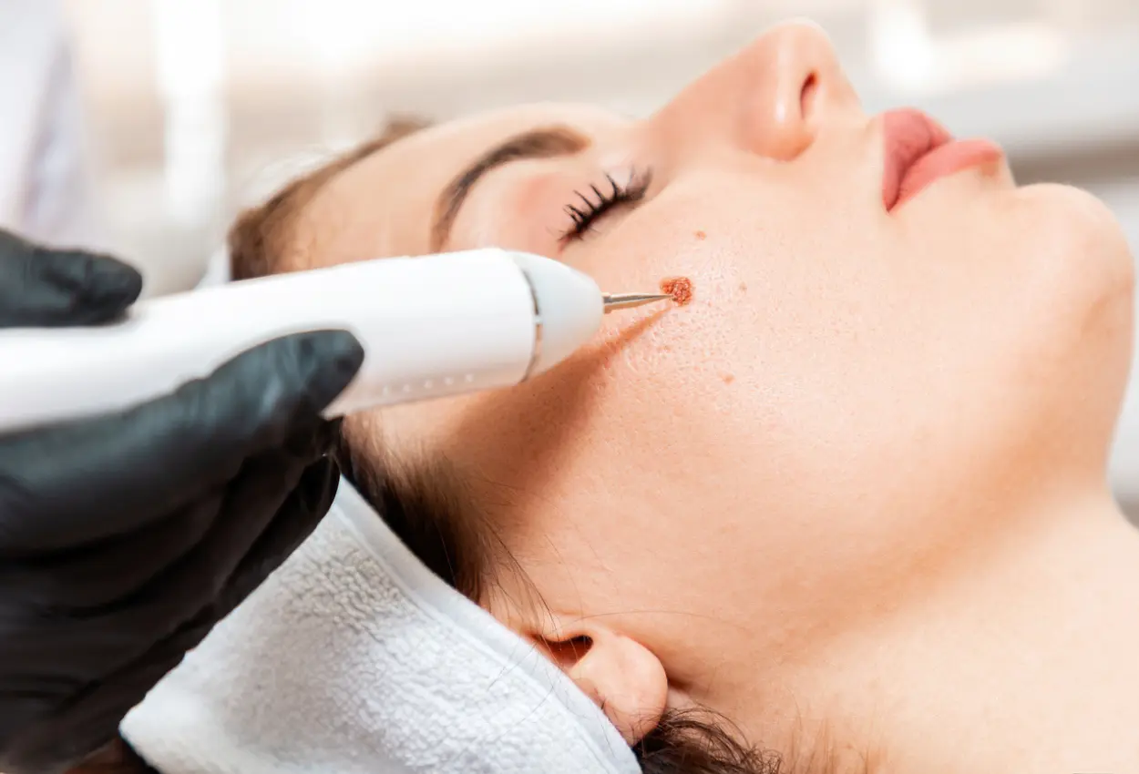 Frequently Asked Questions About Multiple Cryotherapy Treatments Shrewsbury